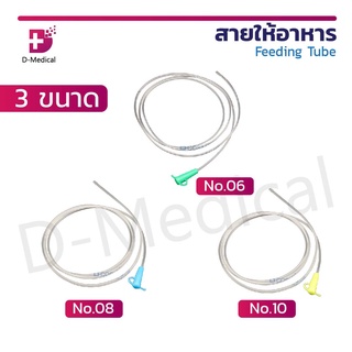 สายให้อาหาร Feeding Tube  (ปลายปิด)  สามารถใช้กับกระบอกเออร์ริเกจได้ ผ่านการอบ EO GAS