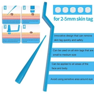 ✓✓จัดส่งในไทย✓✓ อุปกรณ์กำจัดหูด ไฝ ติ่งเนื้อ หลุดออกอย่างง่ายดาย Medical Skin Tag Kill Remover ไม่ต้องใช้ เครื่องจี้ไฝ