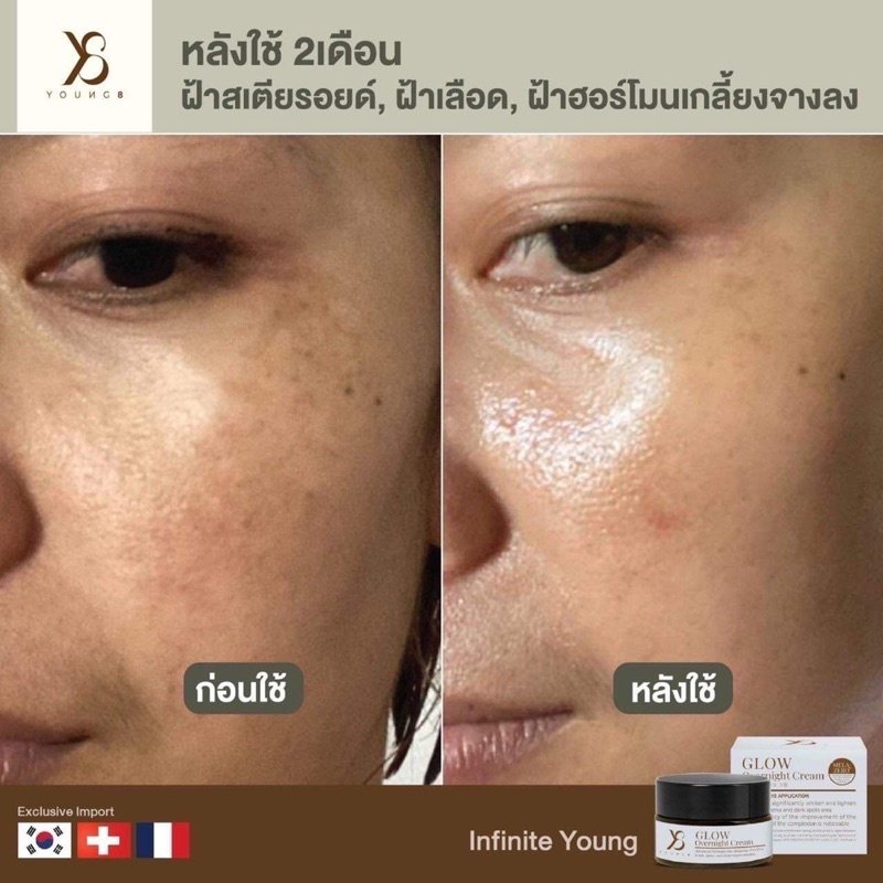 ครีม Y8 Glow Overnight Cream กันแดดy8 เคลียร์ผิว ฝ้า กระ ริ้วรอยเกลี้ยง ด้วยศาสตร์แห่งรางวัล