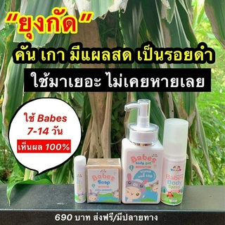 BABES บาเบส ผลิตภัณฑ์สำหรับเด็กโดยเฉพาะ ลดอาการคัน แพ้ยุง ลดรอยดำ เห็นผลชัดเจน หมดปัญหาผิวลูกน้อย