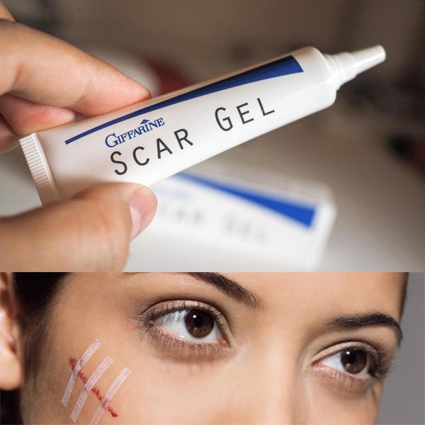 สการ์ เจล GiffarineScar Gel เจล ลบรอยแผลเป็น รอยดำ รอยสิว เจลบำรุงผิวสูตรพิเศษ