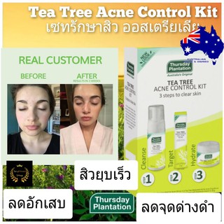 Thursday Plantation Tea Tree Oil Acne Control Kit ทีทรีออย ทีทีออยส์ ทรีทีออย tea tree oil เซทรักษาสิว กรีนทรี