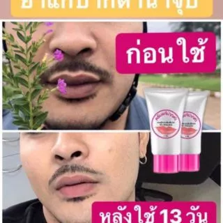 👉👉ครีมแก้ปากดำ จาก >> คลินิค Clinic👈