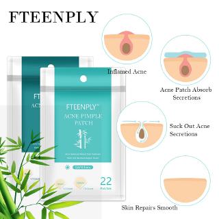 FTEENPLY Acne Patch แผ่นแปะสิว จากประเทศอิตาลี ลดการเกิดอักเสบ 1 แผ่น มี 22 ชิ้น