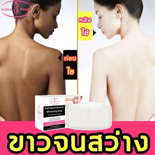 Aichun สบู่ผิวขาว สบู่สูตรลับ ครีมทาผิวขาวถาวรสบู่ เร่งผิวขาว สบู่สูตรเฉพาะ (ช่วยทำความสะอาดใบหน้า และร่างกาย L09