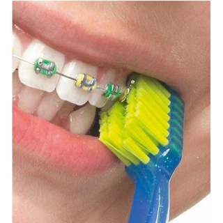 แปรงสีฟันสำหรับคนจัดฟัน CURAPROX CS Ortho