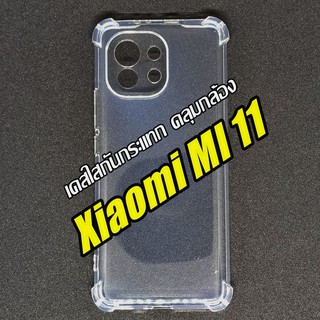 🇹🇭 เคสใสกันกระแทก Xiaomi Mi 11 mi11 คลุมกล้อง เคสใสขอบมุมกันกระแทก เสียวหมี่ กันเลนส์กล้อง