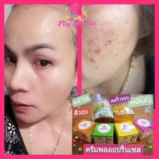 ครีมพลอยปริ้นเซส Ploy Princess ครีมแก้ฝ้า ลดสิว ส่งฟรี