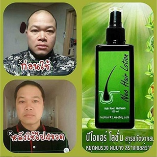 Neo Hair Lotion 120ml ครีมบำรุงผม เอสเซ้นส์ผม สมุนไพร ปลูกผม นีโอแฮร์ โลชั่น