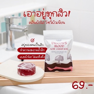 สบู่เลือดมังกร Dragons Blood acne clean soapลดสิว ฝ้า กระ รอยสิวให้ความชุ่มชื่น สบู่ล้างหน้าออร์แกนิค