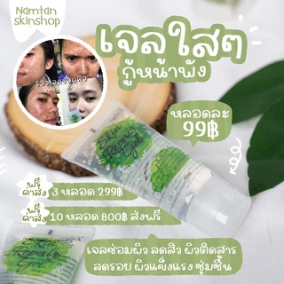 🥑 เจลซ่อมผิว by erika ลดสิว ผด ผื่น ลดรอยดำรอยแดงของสิว ลดเลือนจุดด่างดำ แพ้ง่ายใช้ได้ สินค้าพร้อมส่ง 🌙 รับตัวแทนจำหน่าย