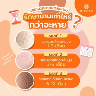 Be Better ครีมลดรอยแตกลาย แบบซอง10g. กล่องx6ชิ้น ลดรอยก้นลาย ขาลาย แขนลาย ท้องลาย รอยแตกสีแดง สีดำ สีขาว สีม่วง