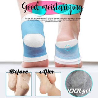 (1คู่)Gel heel Socks ถุงเท้าบำรุงส้นเท้า ช่วยบำรุงส้นเท้าที่แตก