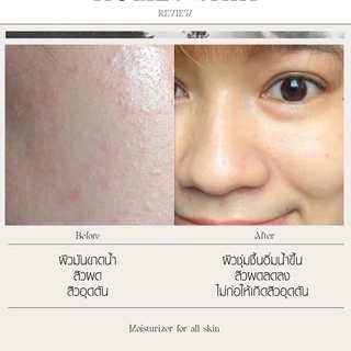 สูตรใหม่มอยซ์เจอร์ไรซ์เซอร์เลอโฉม ฮิวเมคสกิน (Humec Skin) พร้อมส่ง