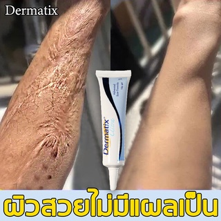 Dermatix 15gเดอร์มาติกซ์ ครีมลบแผลเป็น เจลซ่อมแซม ลบรอยแผลเป็น แผลผ่าตัด น้ำร้อนลวก ลดเลือนรอยแผลเป็น เจลรักษาแผลเป็น ยา