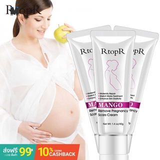 postpartum stretch mark cream