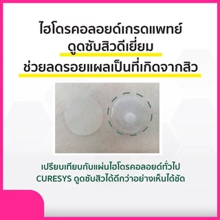 Curesys Niacin Acvita White Patch 18 dots แผ่นแปะสิว ดูดซับสิวพร้อมลดรอย ดูดเกลี้ยง แผ่นบาง เนียน ติดแน่น