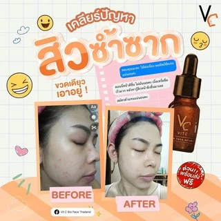 Vit C bio face serum VC เซรั่มวิตามินซี วิตซีน้องฉัตร 10 ml. (ของแท้100%)
