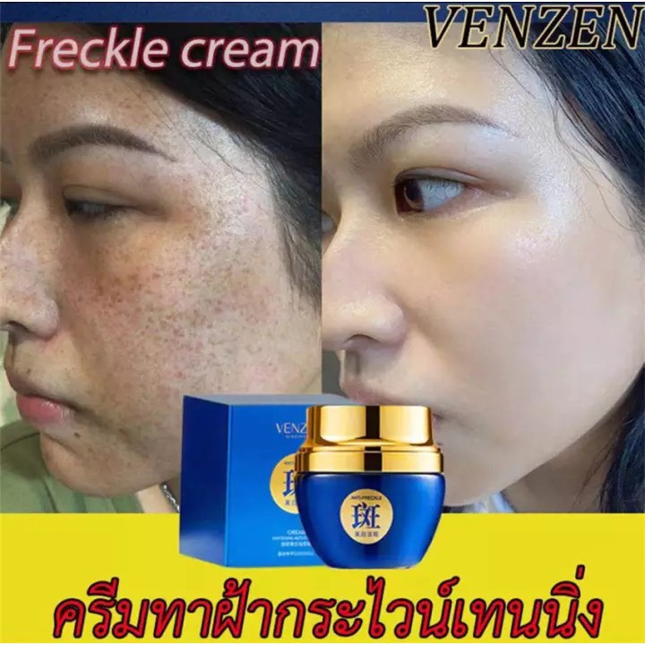 VENZENครีมทาฝ้า50g ครีมไวท์เทนนิ่ง ไวท์เทนนิ่งครีม กำจัดฝ้า จุดด่างดำ ฝ้า กระ ริ้วรอย ครีมรักษาฝ้า ล