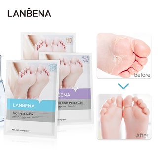 Lanbena ถุงเท้าสปาเท้า กําจัดผิวที่ตายแล้ว ป้องกันส้นเท้าแตก