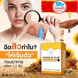 PROPOLISโปรพอลิส30แคปซูล ความงามจากธรรมชาติลดสิวอักเสบเสริมภูมิคุ้มกันต้านหวัด