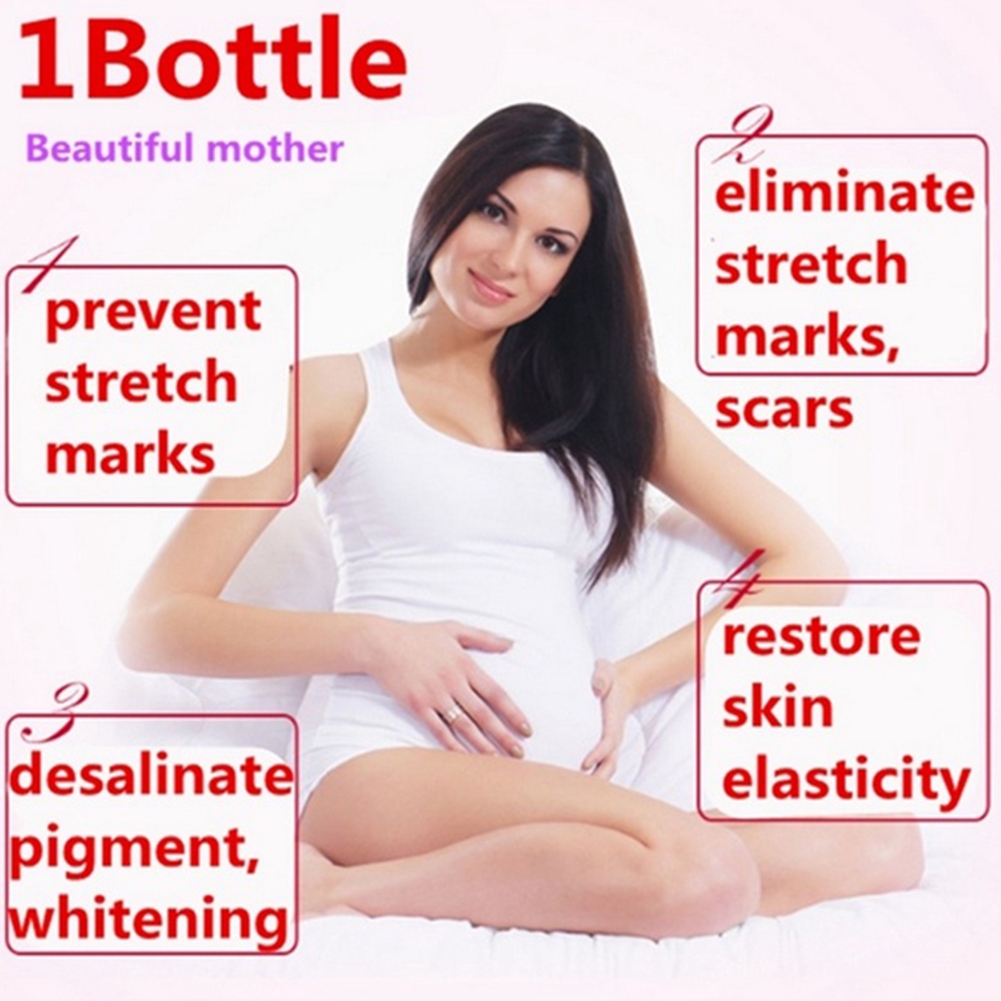 ผลิตภัณฑ์อาบน้ำและดูแลผิวกายowiner Olive Oil Pregnancy Stretch Mark