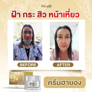 [เก็บโค้ดส่งฟรี+พร้อมส่ง]Hayeong ฮายอง ของแท้จากโรงงาน⭐ 하영สกัดจากโสมเกาหลี หน้าใส แก้ฝ้า หน้าคล้ำ 🇰🇷 ริ้วรอย จุดด่างดำ