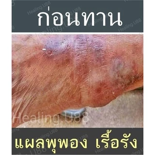 🌱อัลฟัลฟ่า​ Alflafa​🎖️ของแท้💯% มีรีวิว​จริง👍💥ล้างพิษ​ สร้างภูมิ ผิวใส​ ผิวขาว​ ดี​ท็อกซ์​ detox​ กรดไหลย้อน​ อัลฟาฟ่า