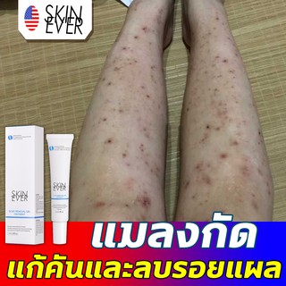 นำเข้าจากอเมริกา SKINEVER ครีมลบแผลเป็น ครีมทาแผลเป็น ครีมลบรอยแผลดำ ครีมลดรอยแผลเป็น ลบรอยแผลเปน ครีมแก้แผลเป็น