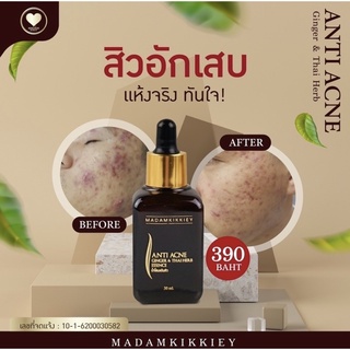 น้ำโสมแต้มสิวอักเสบ (ของแท้ พร้อมส่ง)