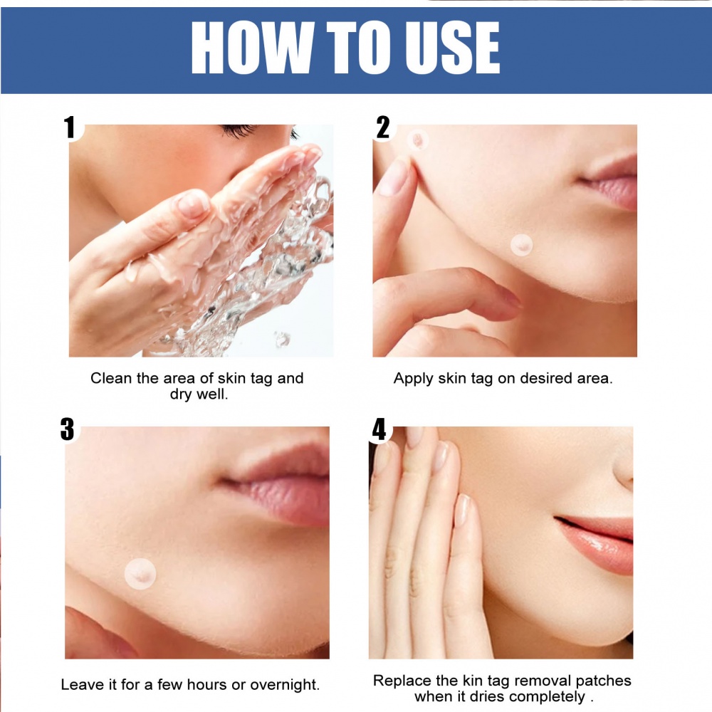 แผ่นแปะกําจัดไฝ ไร้ความเจ็บปวด ส่วนผสมอ่อนโยน จากธรรมชาติ สําหรับทุกสภาพผิว 144 ชิ้น ต่อกล่อง - รูปที่ 5