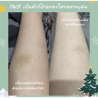 พร้อมส่ง ✨PWB ของแท้ 100%💕new packe💕ครีมบำรุงผิว ลดรอยแตกลาย รอยดำ รอยสิว รอยแผล มีบัตรตัวแทน