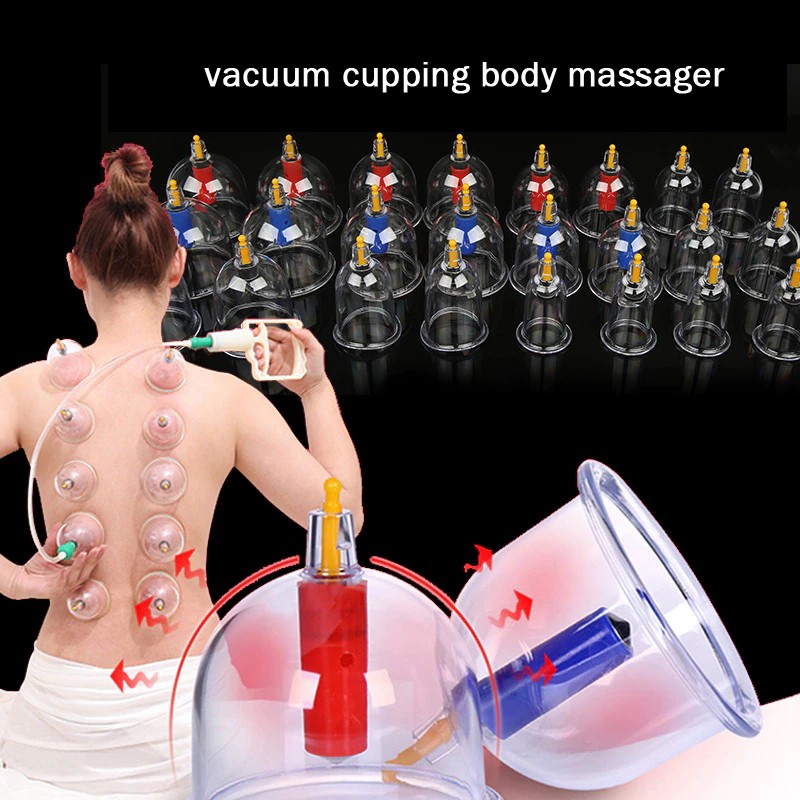 ชุดครอบแก้วนวดตัวสุญญากาศ ตามศาสตร์ของการแพทย์แผนจีน  (12 cups) รุ่น Pull Out A Vacuum Apparatus-13M
