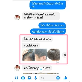 แชมพูสมุนไพรสูตรคุณยาย 7in1 ปลูกผมดก แก้หัวล้าน กระตุ้นการเกิดผมใหม่ เร่งผมยาว ผมดกดำ ลดผมร่วงผมบาง รังแค เชื้อรา