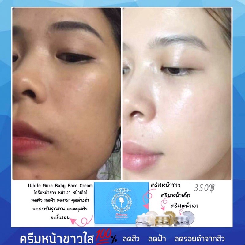 🍇ครีมทาหน้า ครีมหน้าขาวใส ปลอดภัย💯 ครีมบำรุงหน้าขาวเนียนใส ไร้สิว ไร้ฝ้า  ไร้ริ้วรอย ผิวแข็งแรง ผิวอิ่มน้ำ ผิวสุขภาพดี | Shopee Thailand