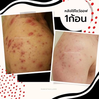 สบู่โชว์ออฟ ปรับสมดุลผิว ลดสิว ลดรอยจากสิว ปรับผิวใส