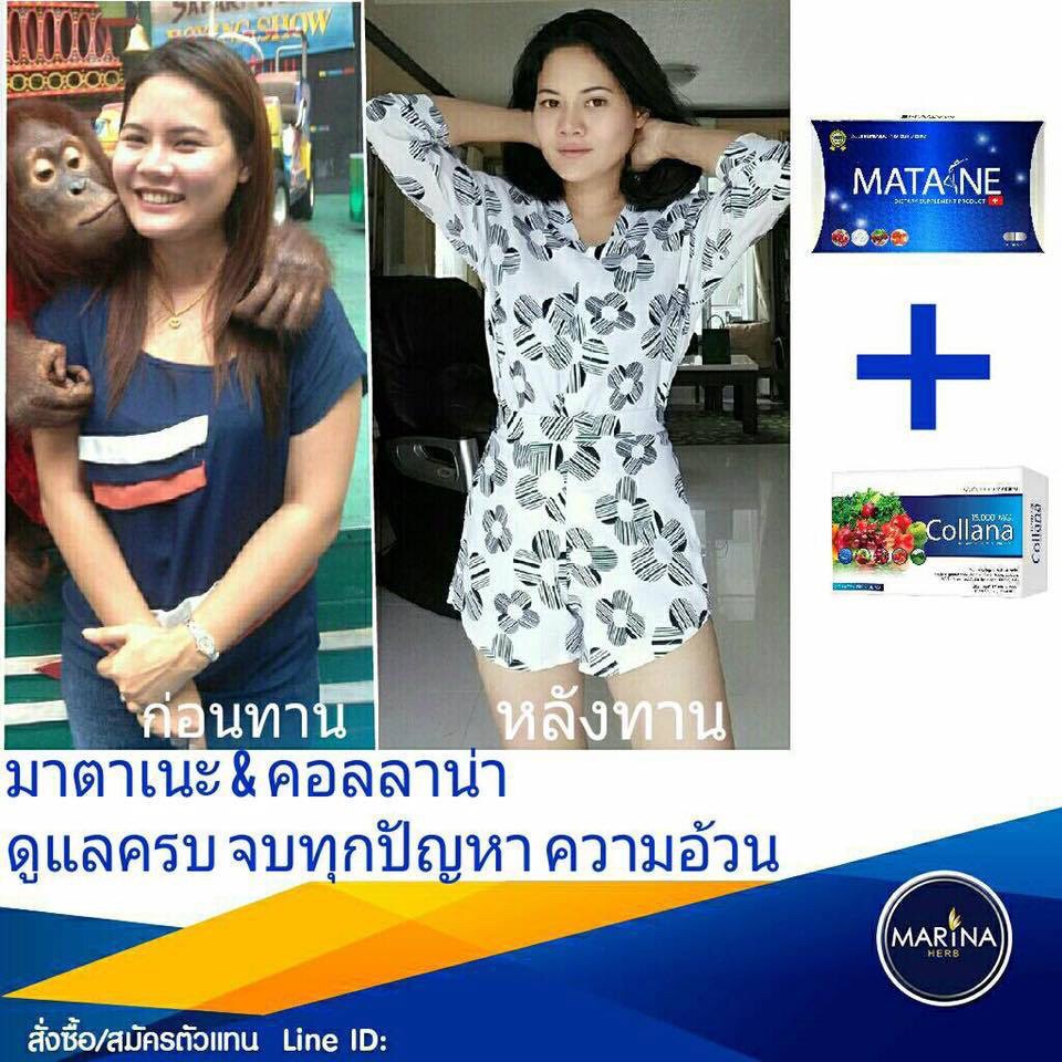 5 แถม 1 Matane มาตาเนะ ผลิตภัณฑ์อาหารเสริมควบคุ้มน้ำหนัก รูปที่ 7