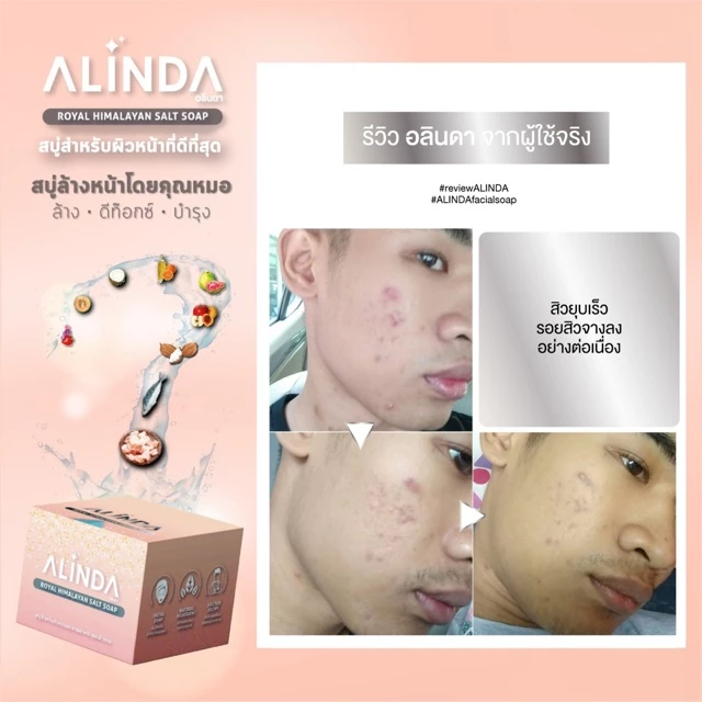 สบู่ล้างหน้าลดสิว ALINDA Royal Himalayan Salt Facial Soap 50g thumbnail 9