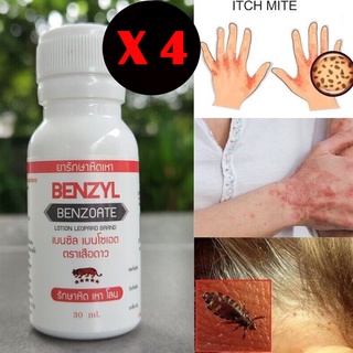 4 ขวด โลชั่นทา ตราเสือดาว scabies รักษา หิด โลน เหา benzyl benzoate 30ml โลนผิวหนังลำตัว คัน