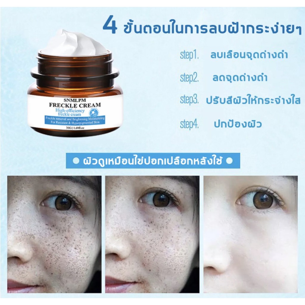snmlpm freckle cream