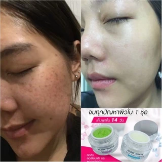 ครีมบริ้งไวท์ ครีมแก้ฝ้า รักษาสิว บำรุงหน้าใส (ส่งฟรีมีปลายทาง🎁 มีของแถม)