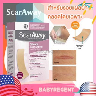 🇺🇸 USA 🇺🇸 USA แผ่นเจลลดรอยแผลผ่าตัด ScarAway for C-Sections (7" X 1.5") ลดรอยแผลเป็น ผ่าตัดคลอด