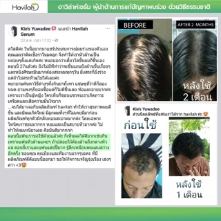 เเชมพูแก้ผมร่วง150ml+ครีมนวดบำรุงผม150ml แก้ผมร่วงผมบาง บำรุงผมนุ่ม ฮาวิล่าห์|Conditioner Havilah+Shampoo