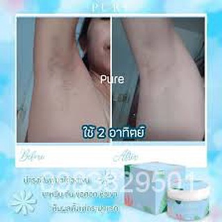 Pure underarm care ครีมเพียว หมดปัญหาเลเซอร์ 50 g. 3Wq0