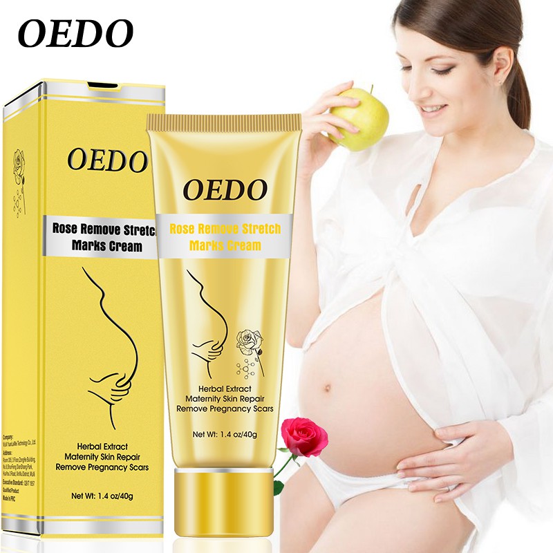 cara menggunakan oedo rose remove stretch mark cream