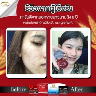 พร้อมส่งแพคเกจใหม่ล่าสุด🔥ครีมโอปิ๊ง O-pingสูตรดั้งเดิมของแท้100% 1 ชุด2ชิ้น