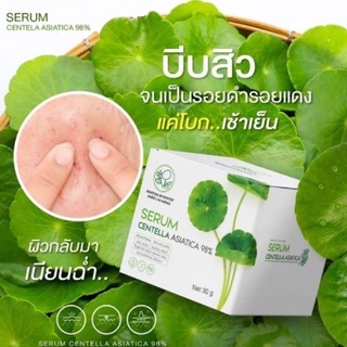 เซรั่ม ใบบัวบก ว่านหางจระเข้ พักหน้ารักษาสิว ผิวแข็งแรง Serum Centella Asiatica 98% Pontina ช่วยปลอบประโลมผิวที่แพ้ง่าย📍