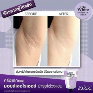 Kiss Total White Underarm Cream 30ml - Sweet Pea Blossom