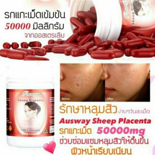 Ausway Sheep placenta50000mg ขนาด 30 เม็ด