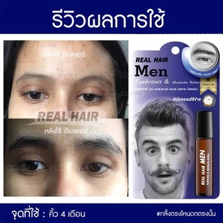 ของแท้!!! Real Hair- เซรั่มปลูกผม คิ้ว หนวด จอน -(สูตรหัวเชื้อ) ใช้ได้ทั้ง ช ญ